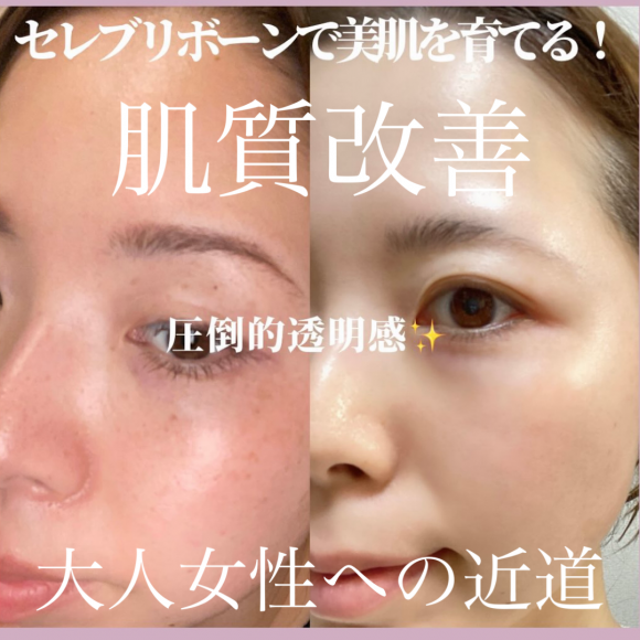 【福岡市西区 エステ】 GRANVIR(グランヴィール)