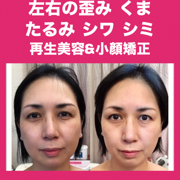 【福岡市西区 エステ】 GRANVIR(グランヴィール)